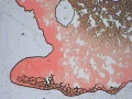 113