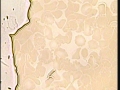 118