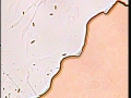123