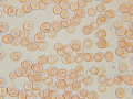 alive native blood microscopy