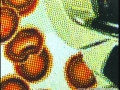 101