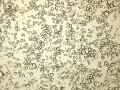 C20160411_142426287